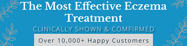 Most Effective Eczema Treatment